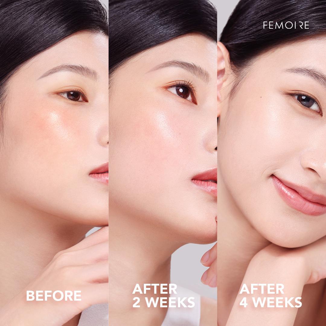 Before-and-after skincare results of a woman using Femoire products: the first image shows her bare skin with visible unevenness; the second image after 2 weeks reveals a brighter and clearer complexion; the third image after 4 weeks highlights smooth, radiant, and glowing skin, demonstrating noticeable improvements over time