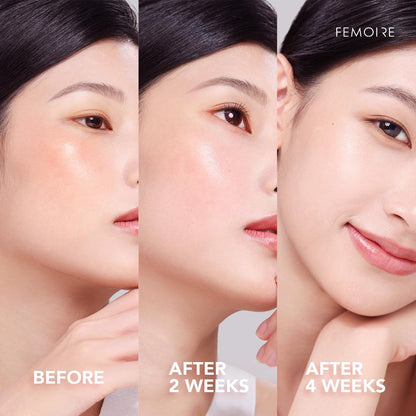 Before-and-after skincare results of a woman using Femoire products: the first image shows her bare skin with visible unevenness; the second image after 2 weeks reveals a brighter and clearer complexion; the third image after 4 weeks highlights smooth, radiant, and glowing skin, demonstrating noticeable improvements over time
